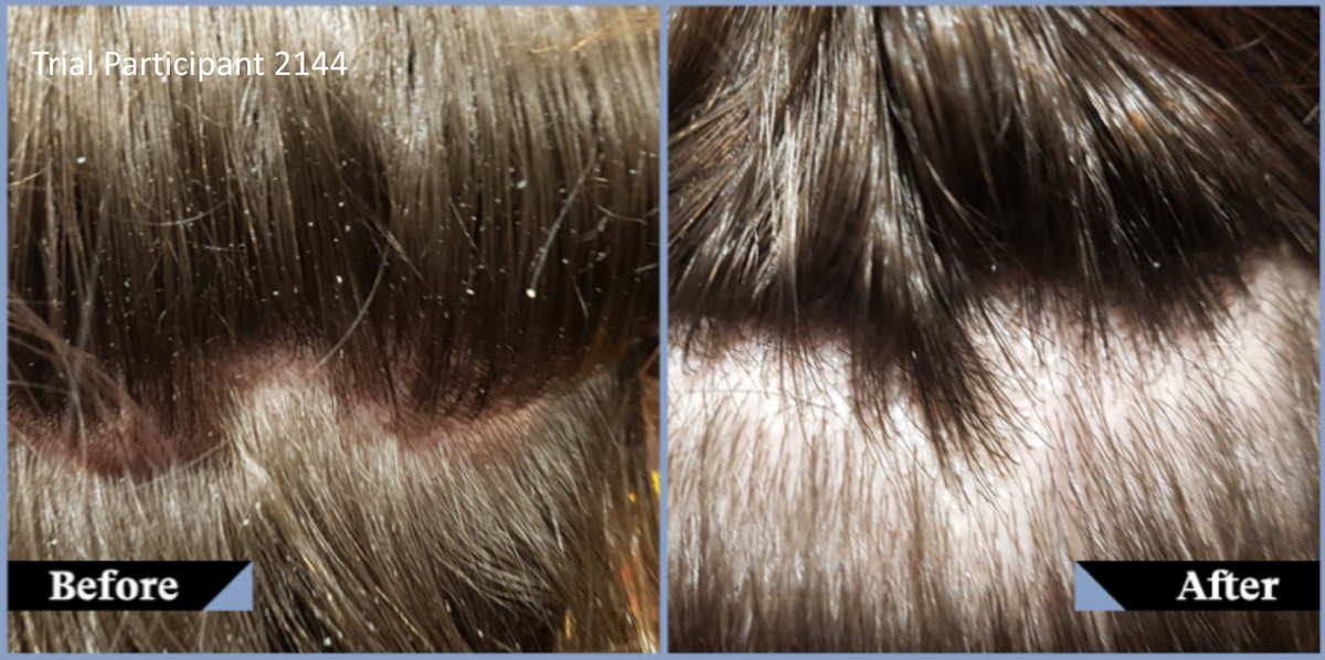 Most shampoos clean hair