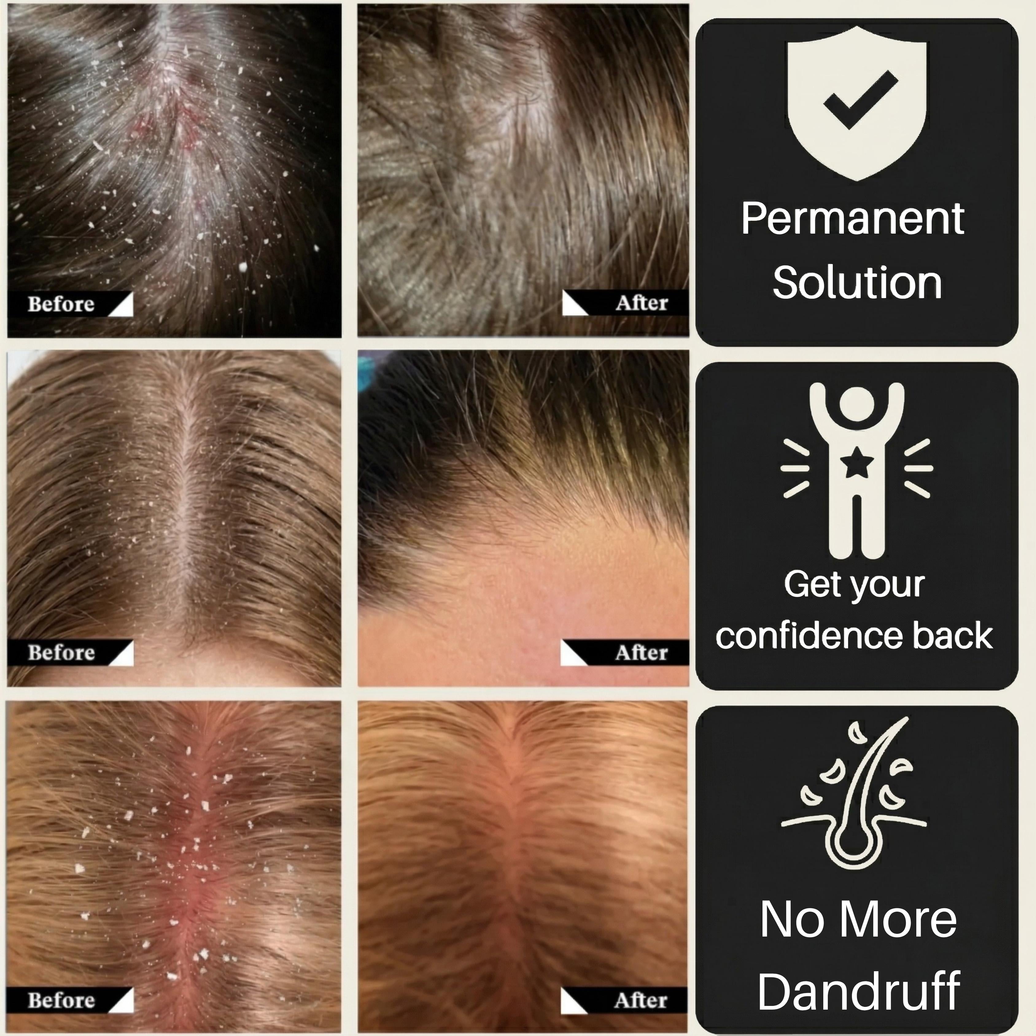 DermaKB® | The 3-Step Solution That Actually Works - 180 Day Supply