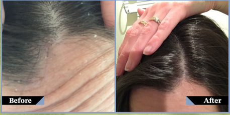 It’s not just dandruff